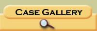 Case Gallery (Current Mode)